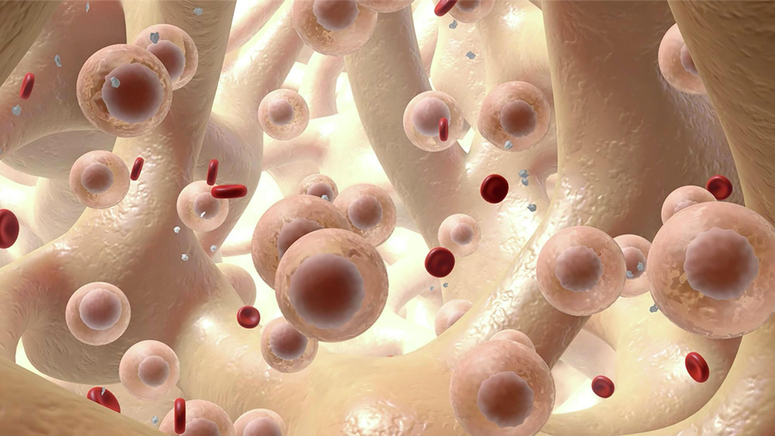 Understanding Leukemia.jpg