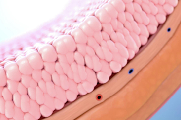 Understanding Bladder Cancer.jpg