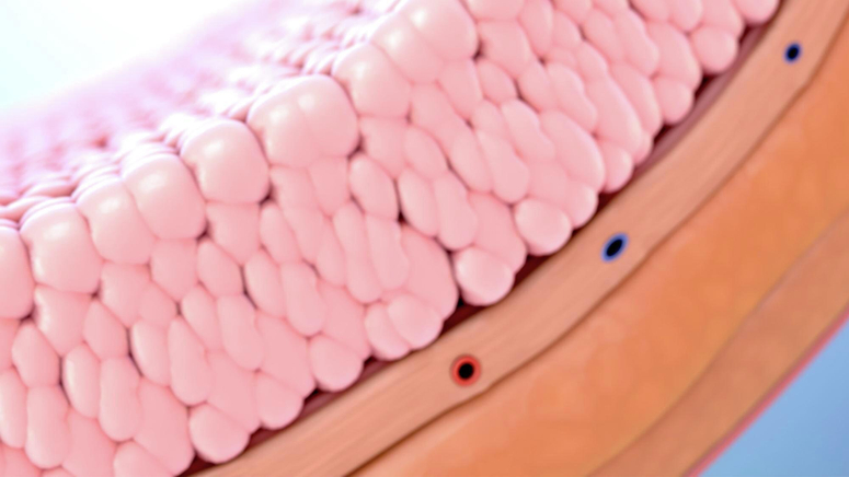 Understanding Bladder Cancer.jpg