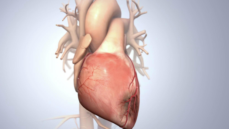 Acute Coronary Syndrome and Heart Attack.jpg