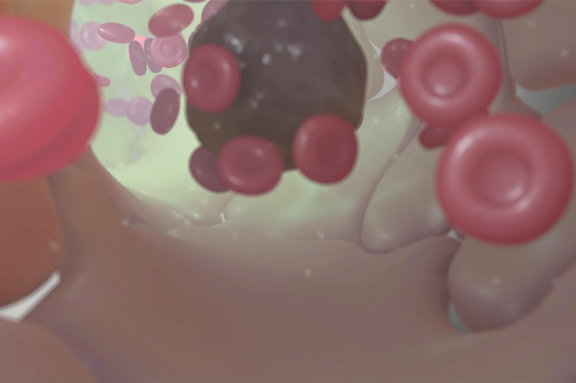 Targeted Therapies Available at Mercy in Baltimore