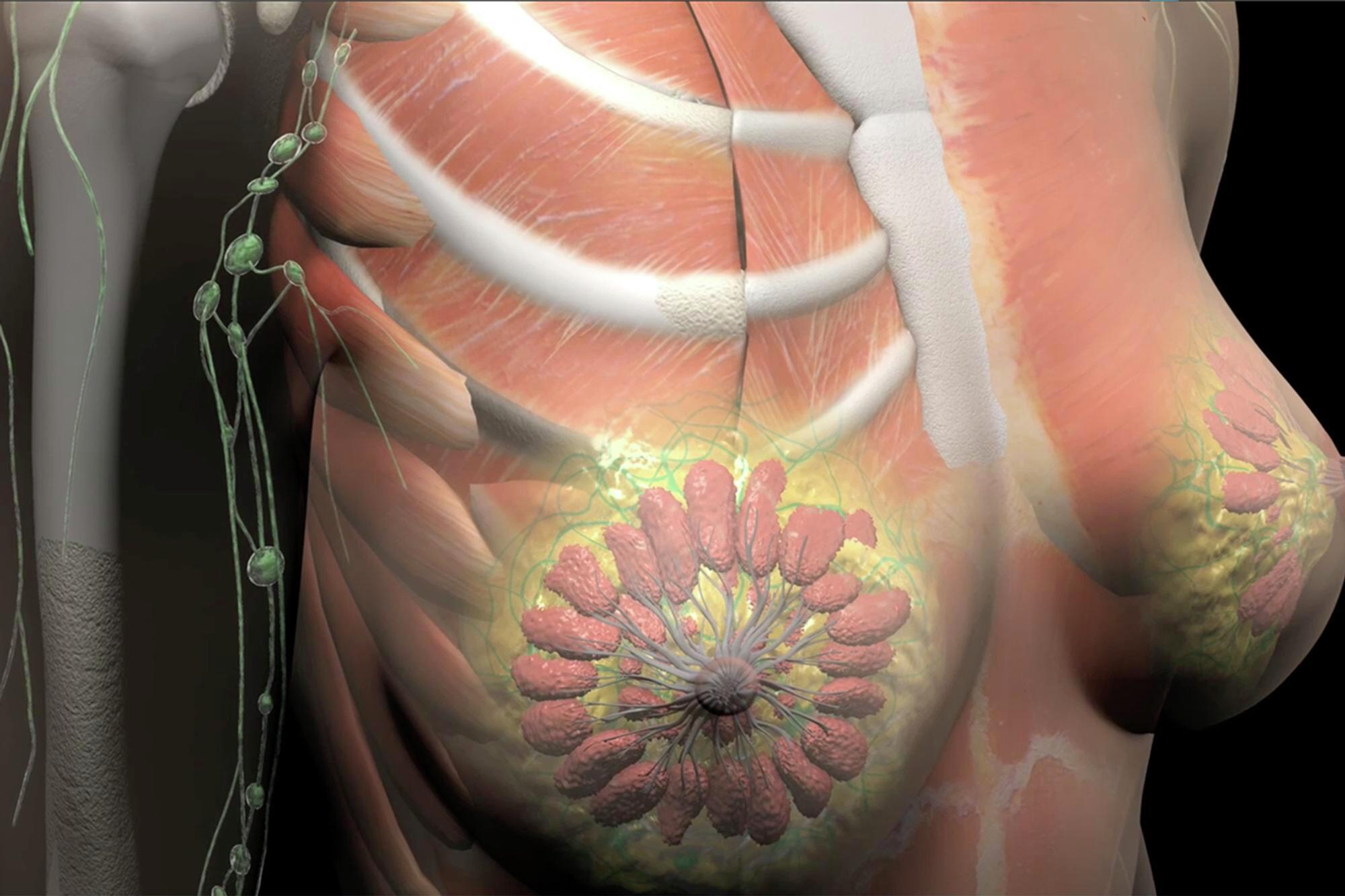 Breast Cancer Diagnosis and Treatment in Baltimore - Breast Center at Mercy, image size:2000x1333