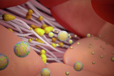 Hyperlipidemia (High Cholesterol).jpg