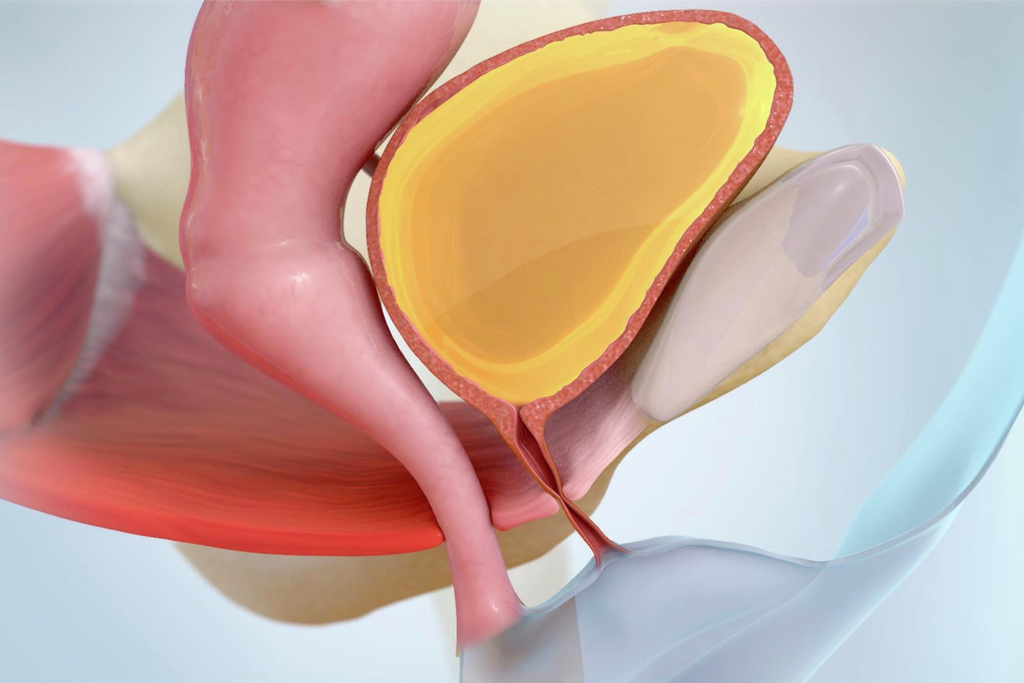 Urinary Incontinence Doctors - Baltimore - Mercy