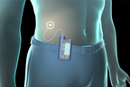 Insulin Pump.jpg