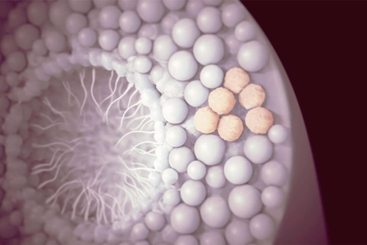 Testicular Cancer.jpg