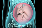 Cesarean Section Delivery.jpg