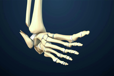 Ankle Fracture Repair.jpg