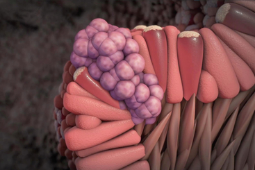 Esophageal Cancer.jpg