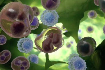 Treatment Options for Lymphoma.jpg