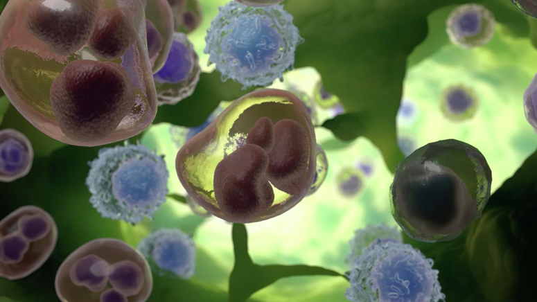 Treatment Options for Lymphoma.jpg