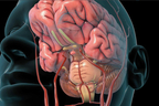 Ischemic Stroke.jpg