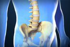 Lumbar Spinal Fusion.jpg