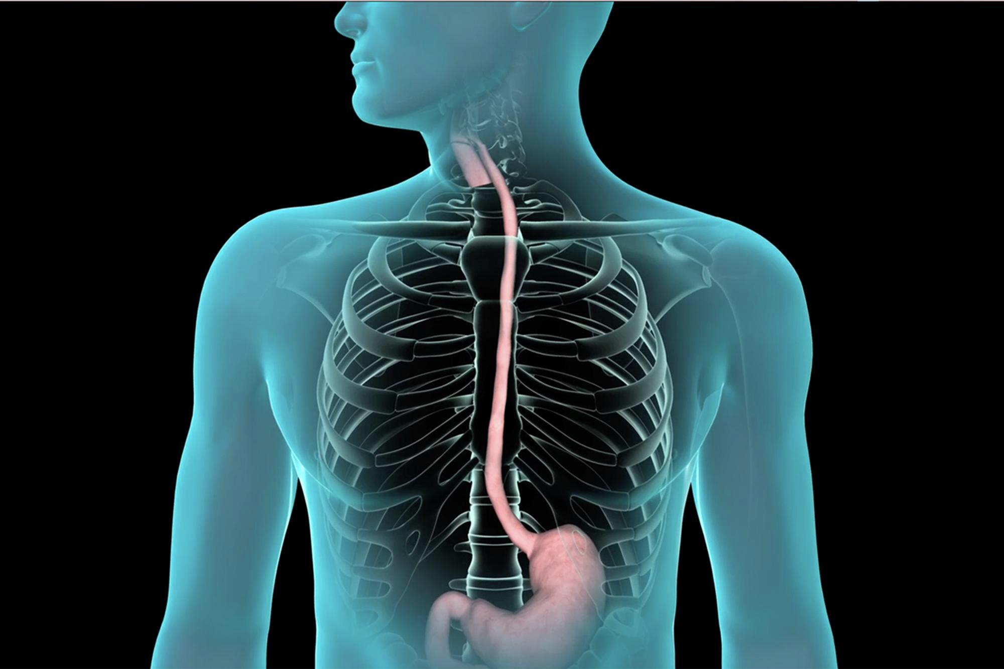 EGD Procedure for Diagnosis and Treatment of Digestive Disease at Mercy