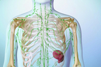 Understanding Lymphoma.jpg