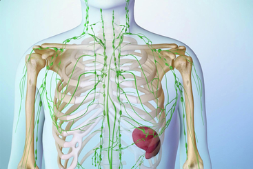 Understanding Lymphoma.jpg