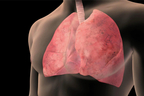 Lung Cancer Symptoms.jpg