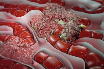 Hepatitis A and B.jpg