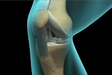 Knee Arthroscopy.jpg