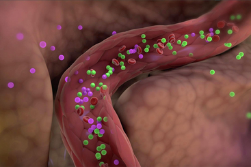 Polycystic Ovary Syndrome (PCOS).jpg