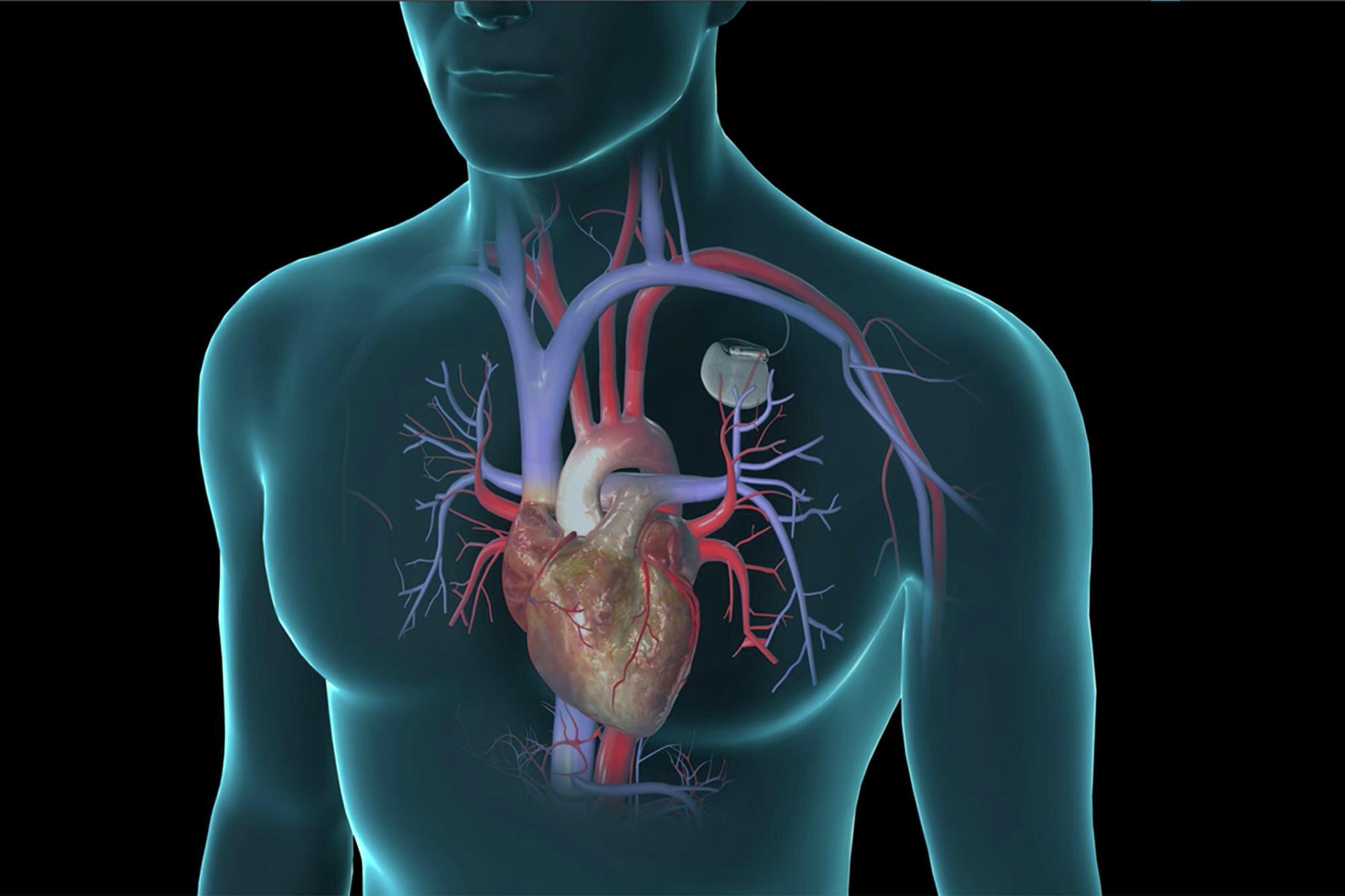 Pacemaker Testing and Defibrillator Monitoring Available at Mercy ...