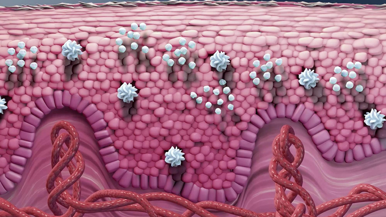 Treatments for Psoriasis.jpg